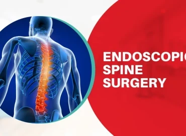 Endoskopik omurga ameliyatı kimler için uygundur?
