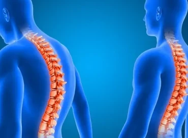 Gergin omurilik sendromunda endoskopik cerrahinin rolü