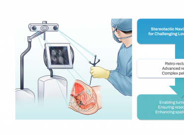 Sakrum tümör cerrahisinde navigasyon sistemlerinin kullanımı