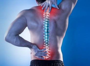 Sırt Fıtığı (Torakal Disk Hernisi)