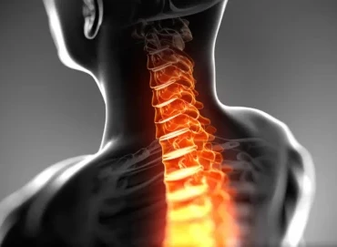 Boyun Fıtığı Ameliyatından Sonra Dikkat Etmeniz Gerekenler Nelerdir?