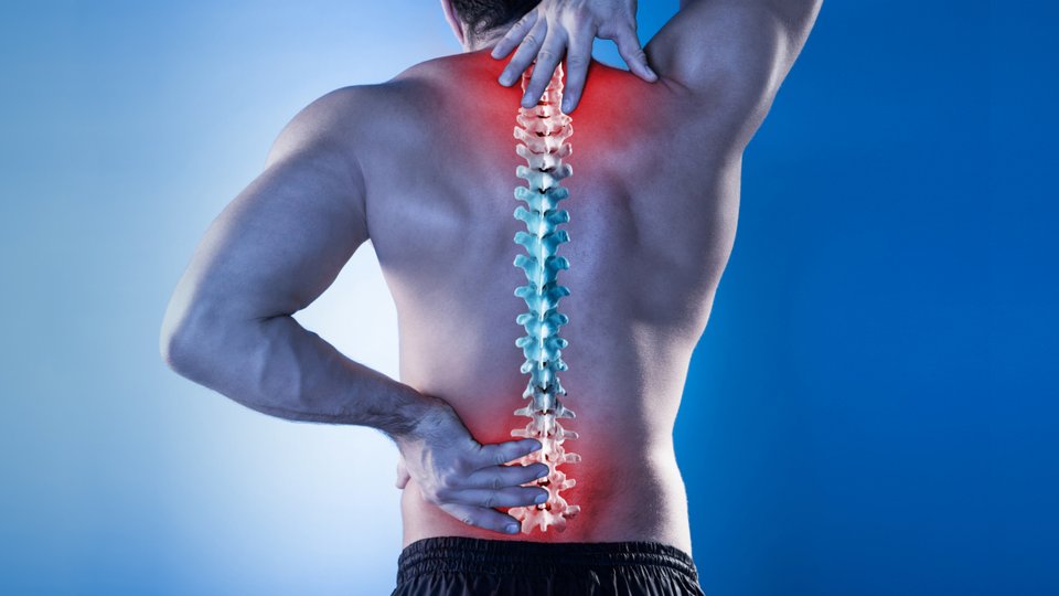 Sırt Fıtığı (Torakal Disk Hernisi)